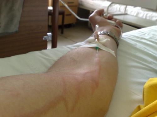 Что можно сделать из медицинских капельниц. Как ставить капельницы